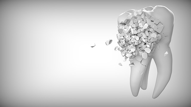 implanty zębowe - czy warto?